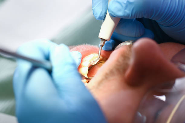 Best Emergency Treatment for Oral Infections in Dansville, NY