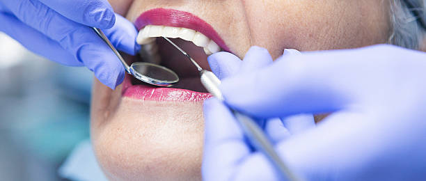 Best Emergency Wisdom Tooth Extraction in Dansville, NY